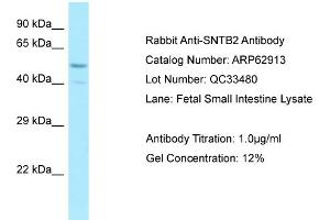 Image no. 1 for anti-Syntrophin, beta 2 (Dystrophin-Associated Protein A1, 59kDa, Basic Component 2) (SNTB2) (Middle Region) antibody (ABIN2789292)