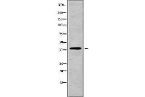 Image no. 1 for anti-Monoacylglycerol O-Acyltransferase 3 (MOGAT3) (C-Term) antibody (ABIN6263325)