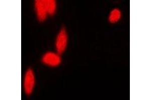 Image no. 2 for anti-Poly(rC) Binding Protein 2 (PCBP2) antibody (ABIN3198128)