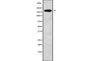 Image no. 1 for anti-HECT, C2 and WW Domain Containing E3 Ubiquitin Protein Ligase 1 (HECW1) (Internal Region) antibody (ABIN6262201)