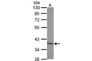 Image no. 1 for anti-RNA (Guanine-9-) Methyltransferase Domain Containing 2 (RG9MTD2) (AA 75-256) antibody (ABIN1500686)