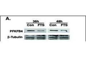 Image no. 2 for anti-6-phosphofructo-2-Kinase/fructose-2,6-Biphosphatase 4 (PFKFB4) (AA 266-296) antibody (ABIN392786)