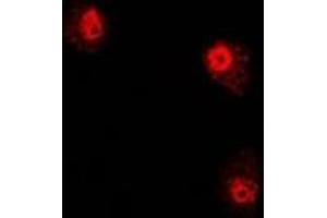 Image no. 1 for anti-Phytanoyl-CoA 2-Hydroxylase (PHYH) antibody (ABIN2966904)