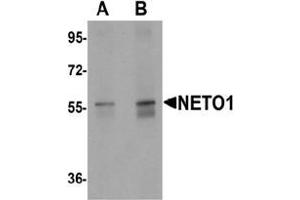 Image no. 2 for anti-Neuropilin (NRP) and Tolloid (TLL)-Like 1 (NETO1) (C-Term) antibody (ABIN1450052)