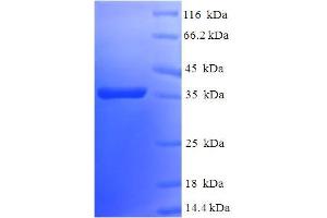 Image no. 1 for BCL2-Like 2 (BCL2L2) (AA 2-193) protein (His-SUMO Tag) (ABIN5711533)