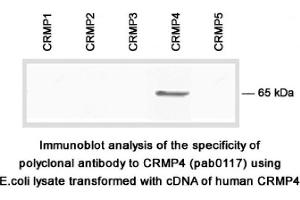 Image no. 1 for anti-Dihydropyrimidinase-Like 3 (DPYSL3) (C-Term) antibody (ABIN347042)