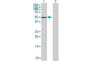 anti-Zinc Finger Protein 383 (ZNF383) (AA 1-475) antibody