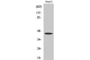 Image no. 1 for anti-Sterol O-Acyltransferase 1 (SOAT1) (Internal Region) antibody (ABIN3183138)