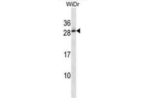 Image no. 1 for anti-Testis Expressed 40 (TEX40) (AA 171-200), (C-Term) antibody (ABIN950716)