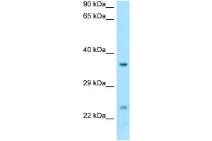 Image no. 1 for anti-D-Tyrosyl-tRNA Deacylase 1 Homolog (S. Cerevisiae) (DTD1) (C-Term) antibody (ABIN2790290)