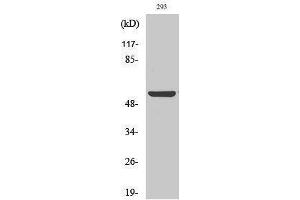 Image no. 1 for anti-Abl-Interactor 1 (ABI1) (Internal Region) antibody (ABIN3183132)