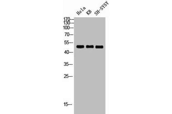 RRS1 antibody  (Internal Region)
