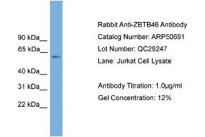 Image no. 2 for anti-Zinc Finger Protein 340 (ZNF340) (Middle Region) antibody (ABIN2784288)