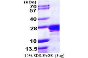 Image no. 1 for RAB2A, Member RAS Oncogene Family (RAB2A) (AA 1-212) protein (His tag) (ABIN667923)