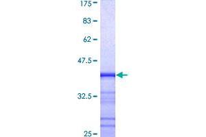 MCF2L Protein (AA 220-319) (GST tag)