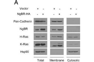 Image no. 8 for anti-HRas proto-oncogene, GTPase (HRAS) (C-Term) antibody (ABIN2857002)