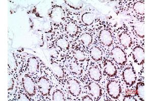 Image no. 2 for anti-Tumor Protein P73 (TP73) (Tyr221) antibody (ABIN3187855)