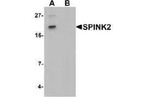 Image no. 2 for anti-serine Peptidase Inhibitor, Kazal Type 2 (Acrosin-Trypsin Inhibitor) (SPINK2) (C-Term) antibody (ABIN1450114)