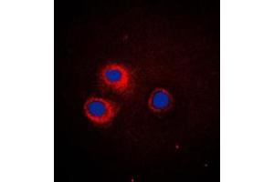 Image no. 1 for anti-CD1e (CD1e) (Center) antibody (ABIN2705761)