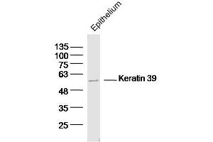 Image no. 1 for anti-Keratin 39 (KRT39) (AA 401-491) antibody (ABIN5675722)