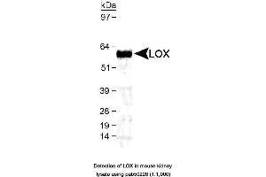 Image no. 1 for anti-Lysyl Oxidase (LOX) (AA 200-300), (AA 300-400) antibody (ABIN363535)