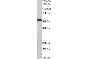 Image no. 2 for anti-ATP Synthase, H+ Transporting, Mitochondrial F1 Complex, alpha Subunit 1, Cardiac Muscle (ATP5A1) (Internal Region) antibody (ABIN1782159)