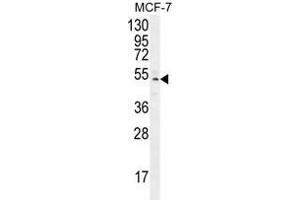 anti-Zinc Finger Protein 829 (ZNF829) (AA 134-163), (Middle Region) antibody