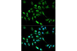 Image no. 2 for anti-Alcohol Dehydrogenase 5 (Class III), chi Polypeptide (ADH5) antibody (ABIN3022769)