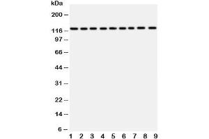 Image no. 3 for anti-Transient Receptor Potential Cation Channel, Subfamily C, Member 3 (TRPC3) (AA 836-851) antibody (ABIN3029230)