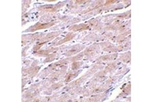 Image no. 1 for anti-Transient Receptor Potential Cation Channel, Subfamily C, Member 3 (TRPC3) (N-Term) antibody (ABIN501060)