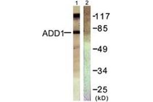 Image no. 1 for anti-Adducin 1 (Alpha) (ADD1) (AA 688-737) antibody (ABIN1532188)