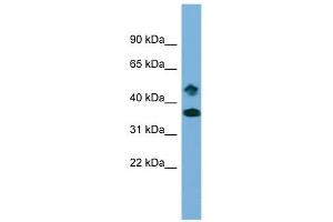 Image no. 1 for anti-SET Domain Containing 6 (SETD6) (Middle Region) antibody (ABIN2784479)