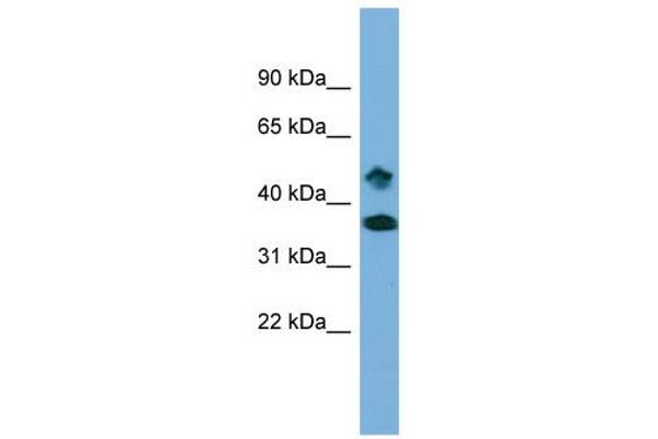 anti-SET Domain Containing 6 (SETD6) (Middle Region) antibody