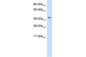 Image no. 1 for anti-Male-Specific Lethal 3 Homolog (MSL3) antibody (ABIN2461970)