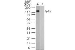 Image no. 2 for anti-SARS-Coronavirus Spike Protein (SARS-CoV S) (AA 1124-1140) antibody (ABIN199984)