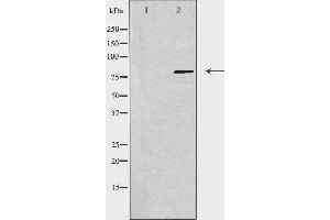 Image no. 1 for anti-Ubiquitin Specific Peptidase 44 (USP44) (Internal Region) antibody (ABIN6258564)