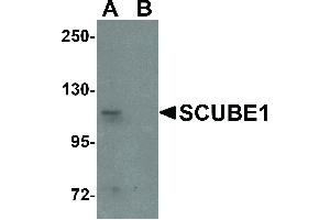 Image no. 1 for anti-Signal Peptide, CUB Domain, EGF-Like 1 (SCUBE1) (Internal Region) antibody (ABIN6655542)