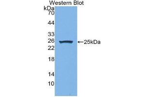 Image no. 1 for anti-Fibroblast Growth Factor Receptor Substrate 2 (FRS2) (AA 268-453) antibody (ABIN1858917)