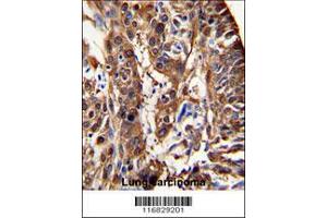 Image no. 1 for anti-Aldehyde Dehydrogenase 3 Family, Member A1 (ALDH3A1) (AA 69-99), (N-Term) antibody (ABIN392318)