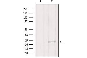 Image no. 2 for anti-Regulator of G-Protein Signaling 1 (RGS1) (Internal Region) antibody (ABIN6258912)