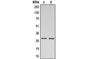 Western blot analysis of CSP expression in A549 (A), K562 (B) whole cell lysates.