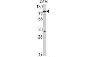 Image no. 2 for anti-Transglutaminase 4 (Prostate) (TGM4) (Middle Region) antibody (ABIN453416)