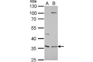 WB Image Decorin antibody detects DCN protein by Western blot analysis.