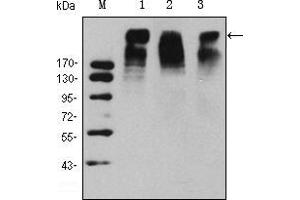 Image no. 2 for anti-Antigen Identified By Monoclonal Antibody Ki-67 (MKI67) antibody (ABIN969234)