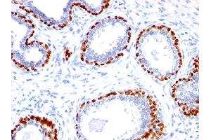 Image no. 2 for anti-Tumor Protein P63 (TP63) (AA 5-17) antibody (ABIN6940969)