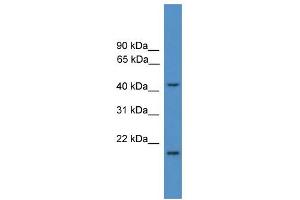 Image no. 1 for anti-Saccharopine Dehydrogenase (SCCPDH) (Middle Region) antibody (ABIN2785529)