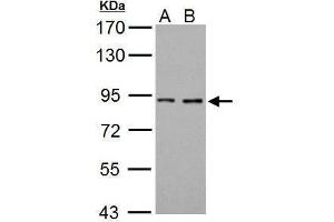 WB Image Sample (30 ug of whole cell lysate) A: 293T B: A431 7.