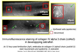 anti-Collagen, Type IV, alpha 3 (COL4A3) (C-Term) antibody