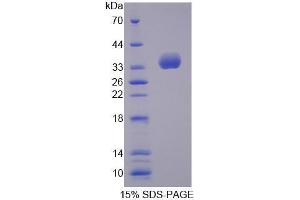 Image no. 1 for Tubulin Folding Cofactor B (TBCB) (AA 1-244) protein (His tag) (ABIN6239644)