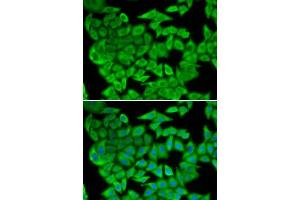 Image no. 2 for anti-Malate Dehydrogenase 2, NAD (Mitochondrial) (MDH2) antibody (ABIN6143667)